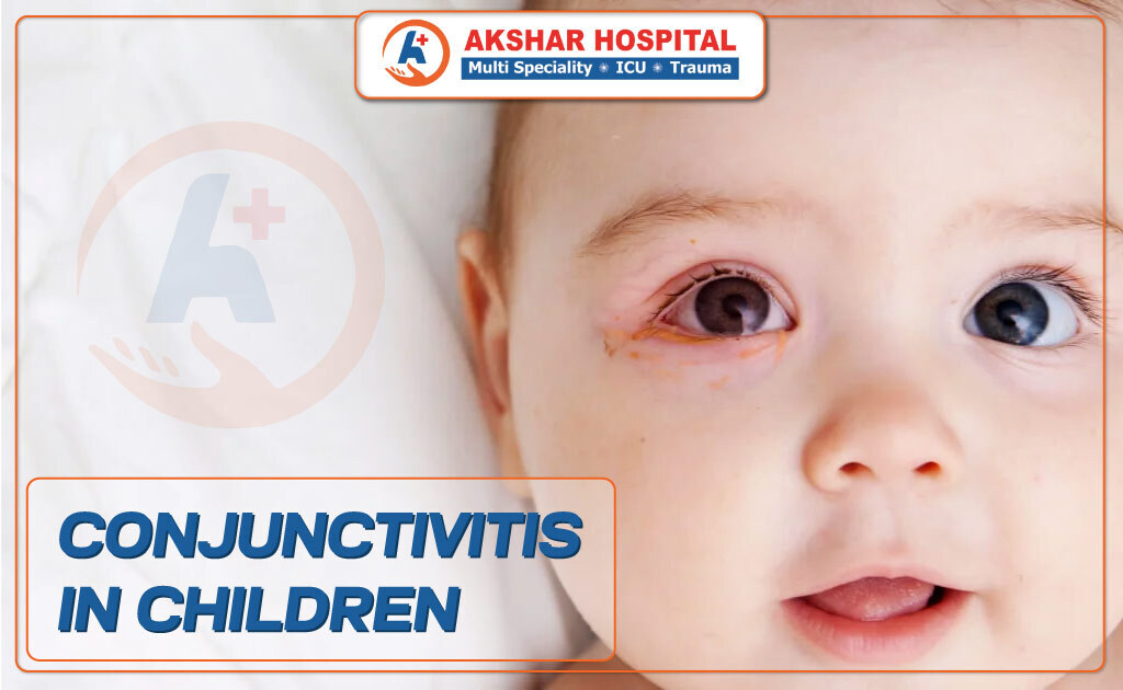 Understand Conjunctivitis in Children