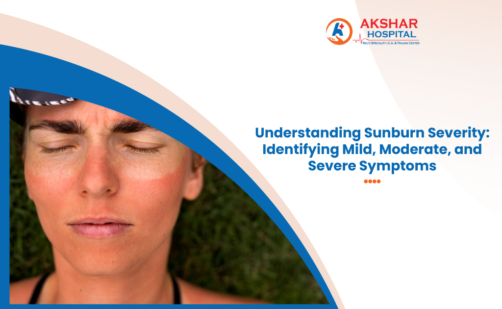 Understanding Sunburn Severity: Identifying Mild, Moderate, and Severe Symptoms