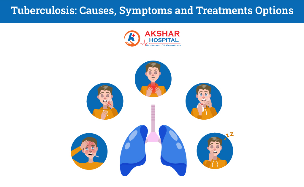 Tuberculosis: Causes, Symptoms, and Treatment Options