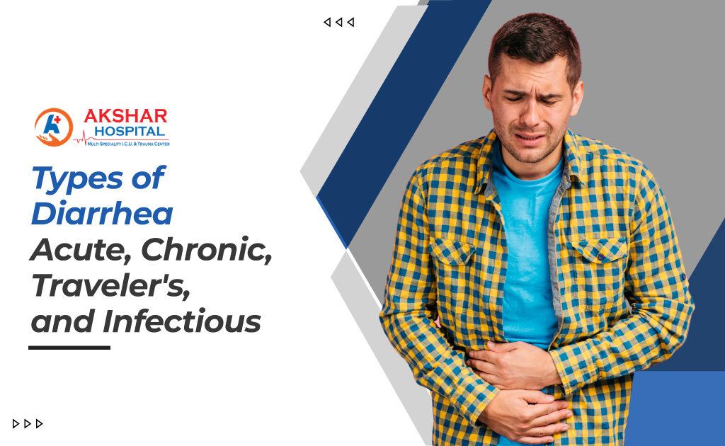 Types of Diarrhea: Acute, Chronic, Traveler's, and Infectious